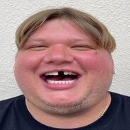 xns